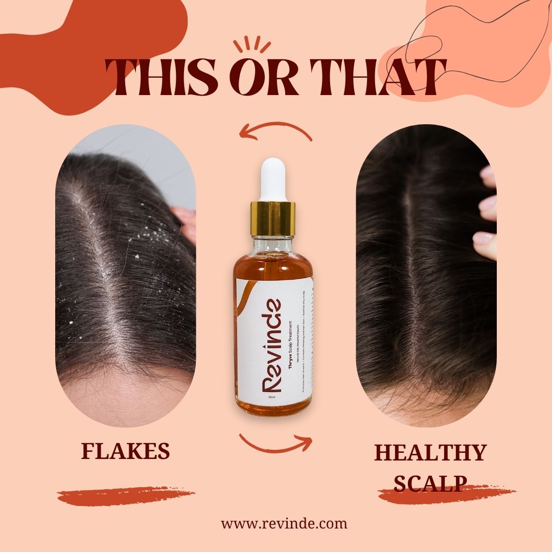 Thryve Scalp Treatment Oil