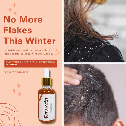 Thryve Scalp Treatment Oil